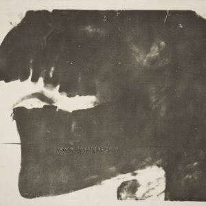 Radiografia de una mandíbula