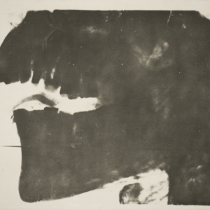 Radiografia de una mandíbula